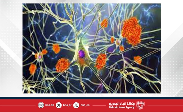 دراسة: بروتين دماغي قد يساعد في إبطاء تطور مرض ألزهايمر