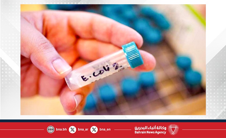 بلجيكا.. وفاة أربعة أشخاص ببكتيريا "آي كولاي" في دور مسنين