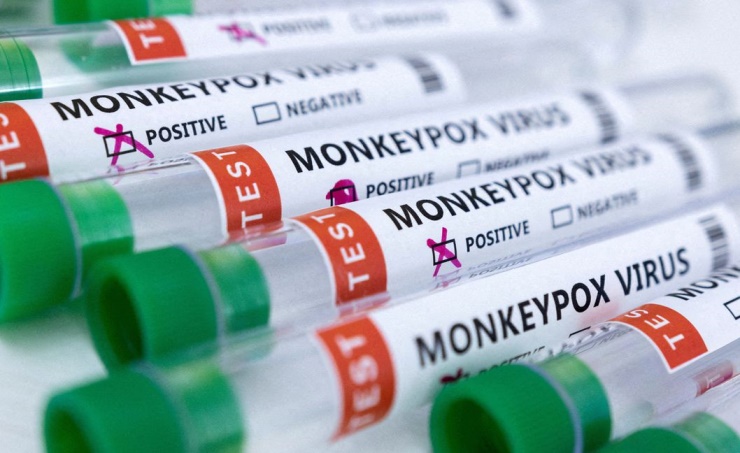 India confirms Asia's first monkeypox death